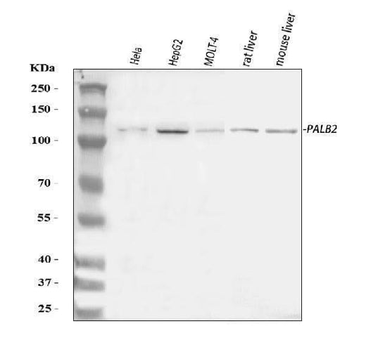 Anti-PALB2 Antibody Picoband® Boster Bio