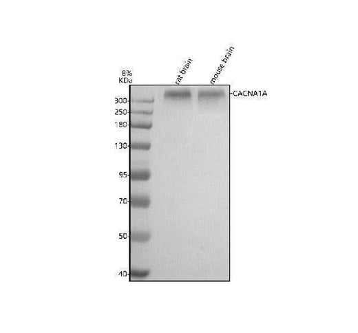 Anti-CACNA1A Antibody Picoband® Boster Bio
