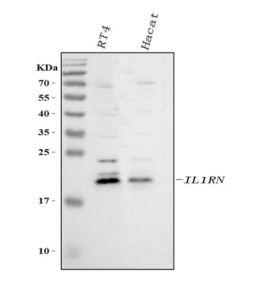 Anti-IL1RA/IL1RN Antibody Picoband® Boster Bio