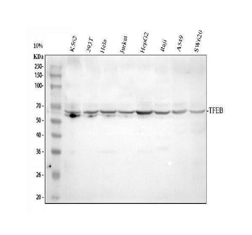 Anti-TFEB Antibody Picoband® Boster Bio