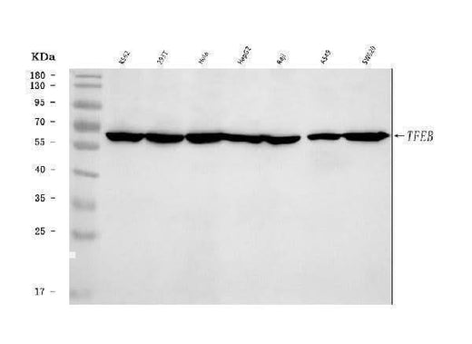 Anti-TFEB Antibody Picoband® Boster Bio