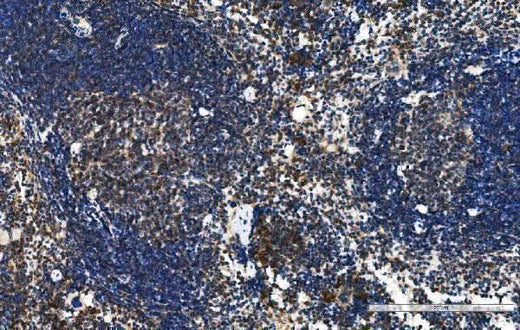 Anti-Cxcr5 Antibody Boster Bio