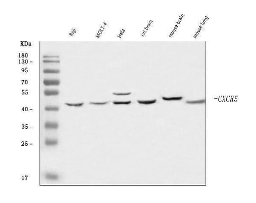 Anti-CXCR5 Antibody Picoband® Boster Bio