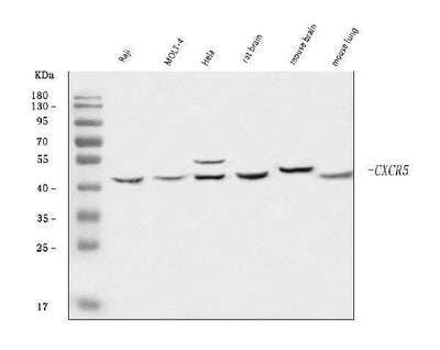 Anti-CXCR5 Antibody Picoband® Boster Bio