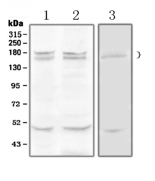 Anti-Thrombospondin/THBS1 Antibody Picoband® Boster Bio