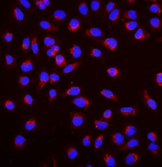 Anti-SGK1 Antibody Picoband® Boster Bio