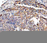 Anti-TRIO Antibody Boster Bio