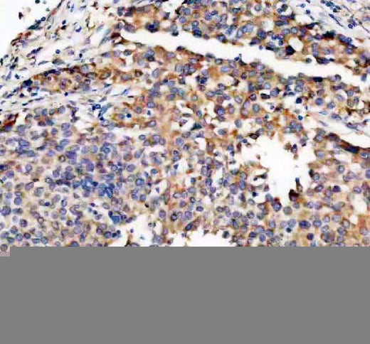 Anti-TRIO Antibody Boster Bio