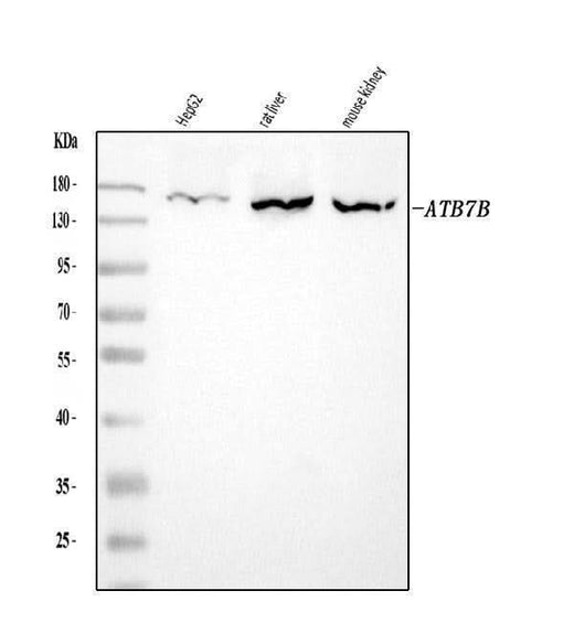 Anti-ATP7B Antibody Picoband® Boster Bio