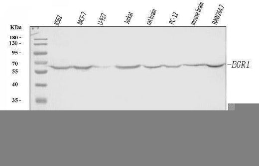 Anti-EGR1 Antibody Picoband® Boster Bio
