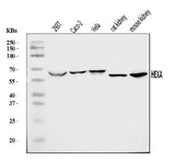 Anti-HEXA Antibody Picoband® Boster Bio