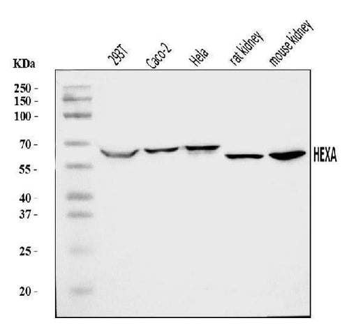 Anti-HEXA Antibody Picoband® Boster Bio