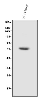 Anti-HEXA Antibody Picoband® Boster Bio