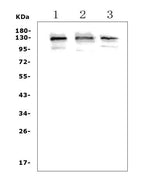 Anti-Growth hormone receptor/GHR Picoband® Antibody Boster Bio