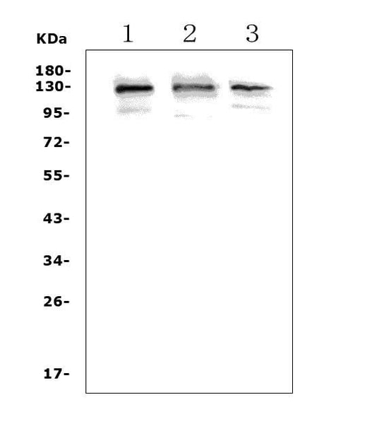 Anti-Growth hormone receptor/GHR Picoband® Antibody Boster Bio