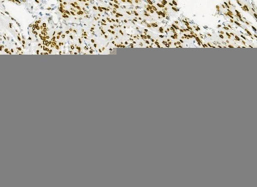 Anti-Emerin/EMD Antibody Picoband® Boster Bio