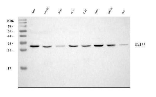 Anti-SNAIL/SNAI1 Antibody Picoband® Boster Bio