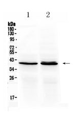 Anti-Ornithine Carbamoyltransferase/OTC Antibody Picoband® Boster Bio
