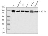 Anti-ROCK1 Antibody Picoband® Boster Bio