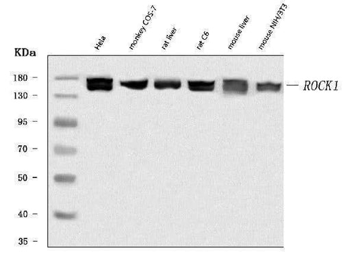 Anti-ROCK1 Antibody Picoband® Boster Bio