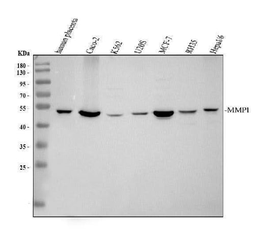 Anti-MMP1 Antibody Picoband® Boster Bio