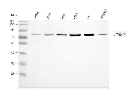 Anti-PKC Alpha/PRKCA Antibody Picoband® Boster Bio