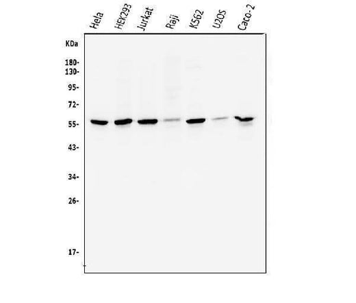 Anti-Cyclin B1/CCNB1 Antibody Picoband® Boster Bio