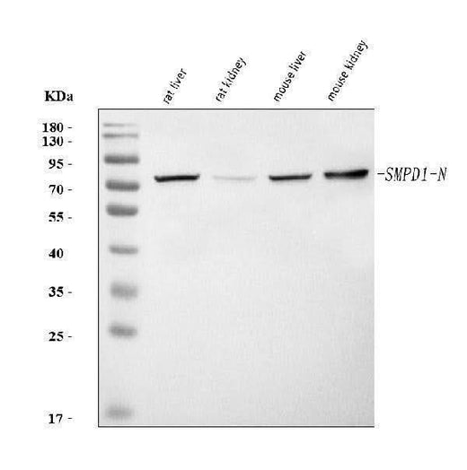 Anti-Smpd1 Antibody Picoband® Boster Bio