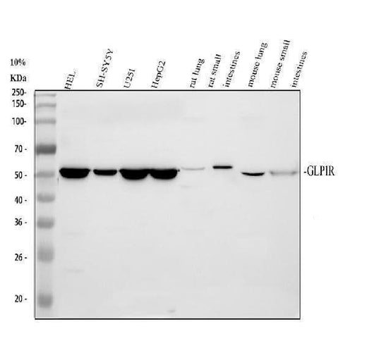 Anti-GLP1R Antibody Picoband® Boster Bio
