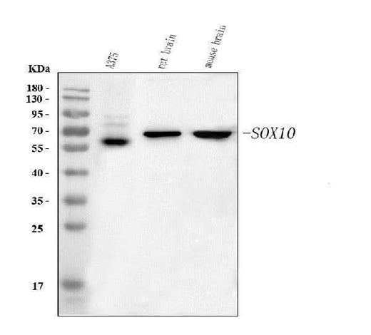 Anti-SOX10 Antibody Picoband® Boster Bio