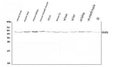 Anti-LOX 1/Olr1 Antibody Picoband® Boster Bio