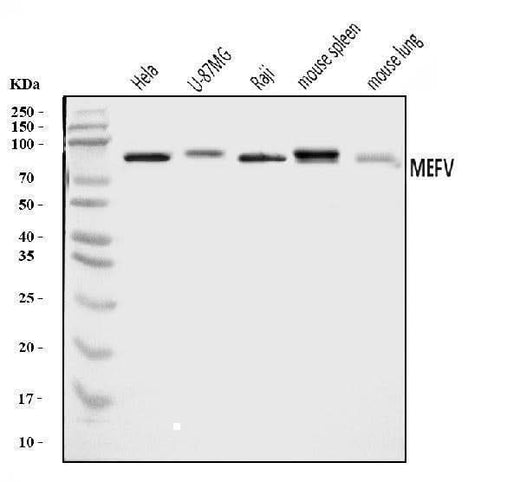 Anti-Pyrin/MEFV Antibody Picoband® Boster Bio