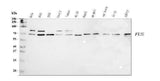 Anti-TLS/FUS Antibody Picoband® Boster Bio