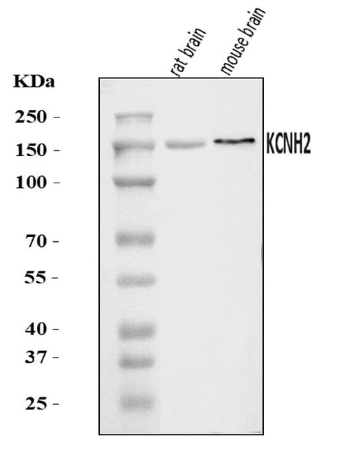 Anti-H-ERG/KCNH2 Antibody Picoband® Boster Bio