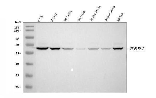 Anti-Estrogen Receptor beta/ESR2 Antibody Picoband® Boster Bio