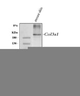 Anti-Collagen III/COL3A1 Antibody Picoband® Boster Bio