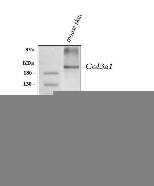 Anti-Collagen III/COL3A1 Antibody Picoband® Boster Bio