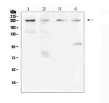 Anti-TRPM7 Antibody Picoband® Boster Bio