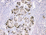 Anti-Fibrinogen gamma chain/FGG Antibody Picoband® Boster Bio