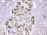 Anti-Fibrinogen gamma chain/FGG Antibody Picoband® Boster Bio
