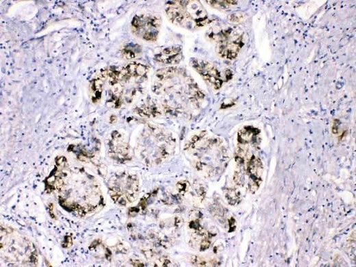 Anti-Fibrinogen gamma chain/FGG Antibody Picoband® Boster Bio