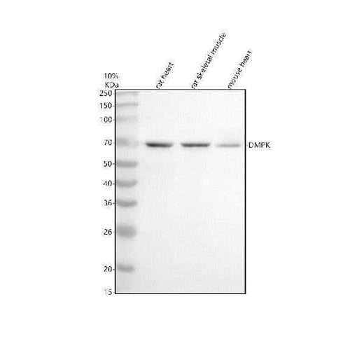 Anti-DMPK Antibody Picoband® Boster Bio