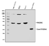Anti-Presenilin 2/AD5/PSEN2 Antibody Picoband® Boster Bio
