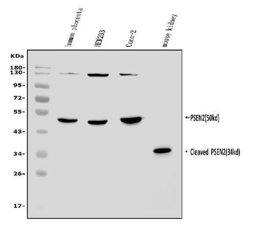 Anti-Presenilin 2/AD5/PSEN2 Antibody Picoband® Boster Bio