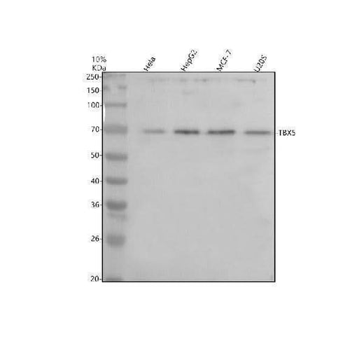 Anti-TBX5 Antibody Picoband® Boster Bio