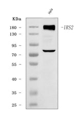 Anti-IRS2 Antibody Picoband® Boster Bio