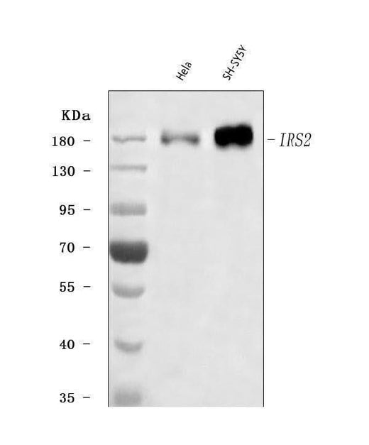 Anti-IRS2 Antibody Picoband® Boster Bio