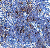 Anti-IL4R Antibody Boster Bio