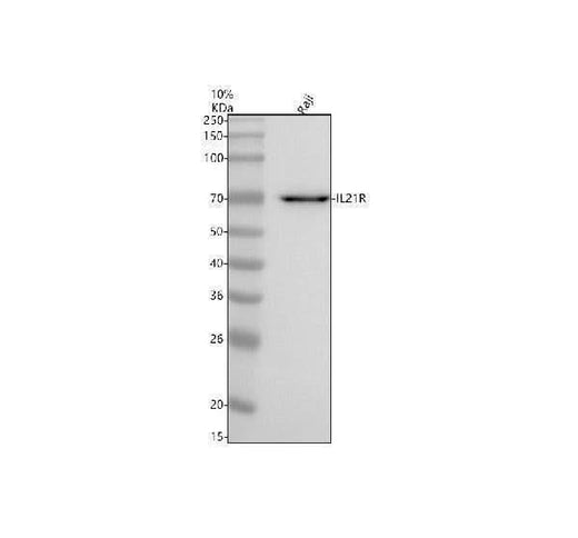 Anti-IL21R Antibody Picoband® Boster Bio