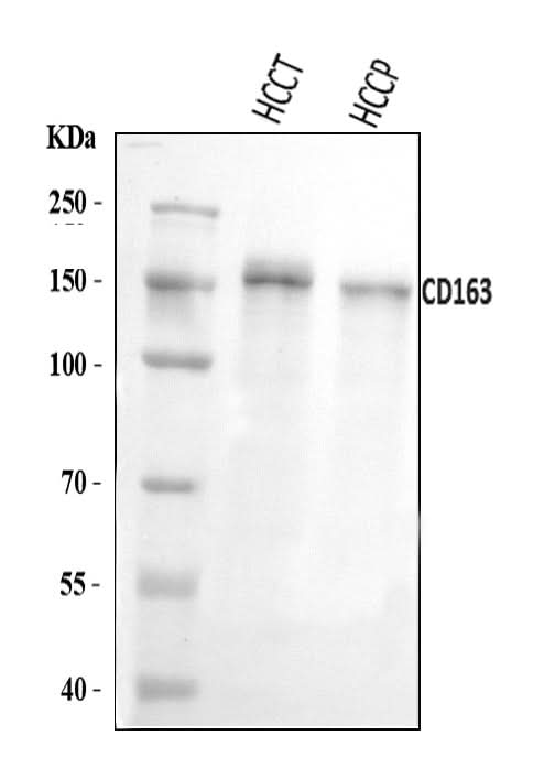 Anti-CD163 Antibody Picoband® Boster Bio